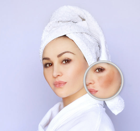 brightening cream, dark spots, sun spots, melasma, hyperpigmentation, kojic acid, pregnancy safe skincare