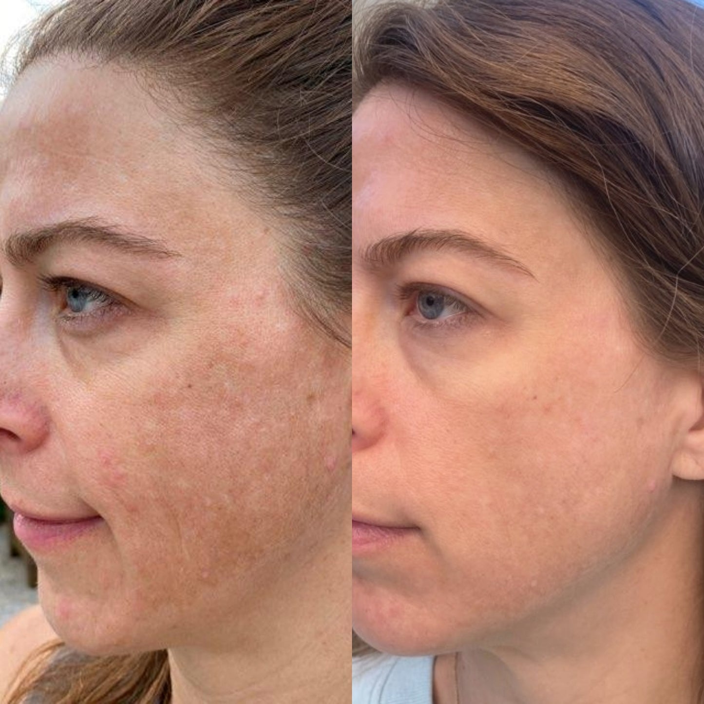 Kojic Brightening Cream