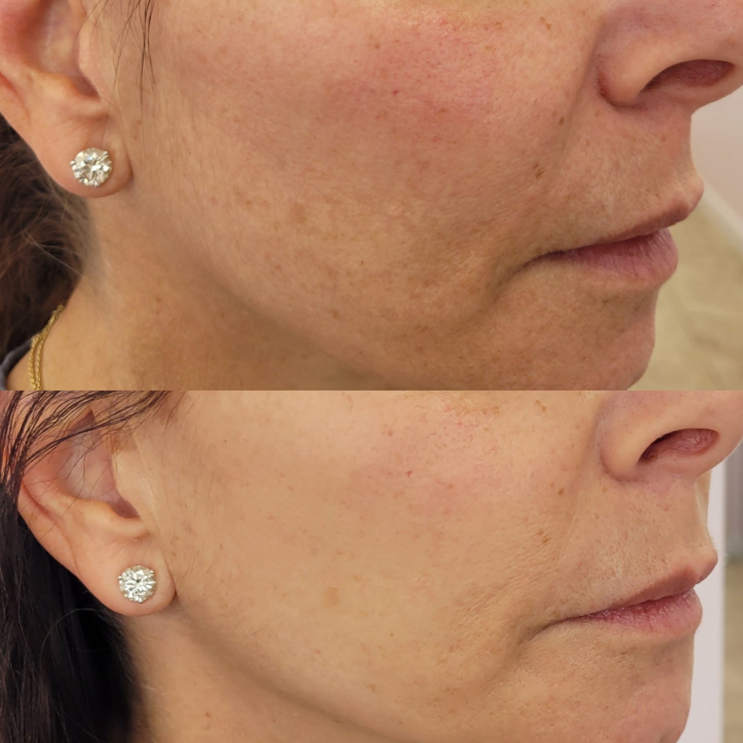 Kojic Brightening Cream