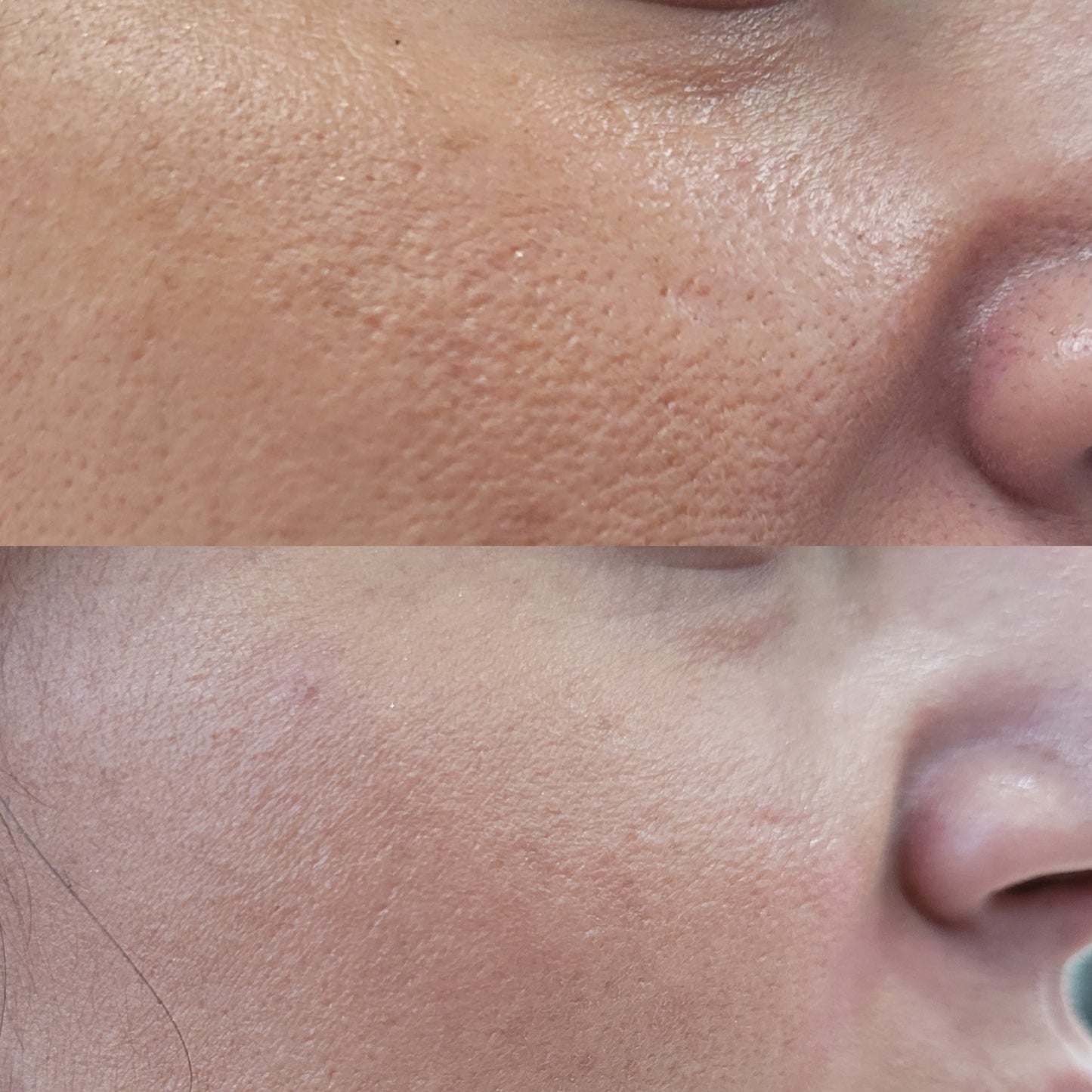 best pore refiner