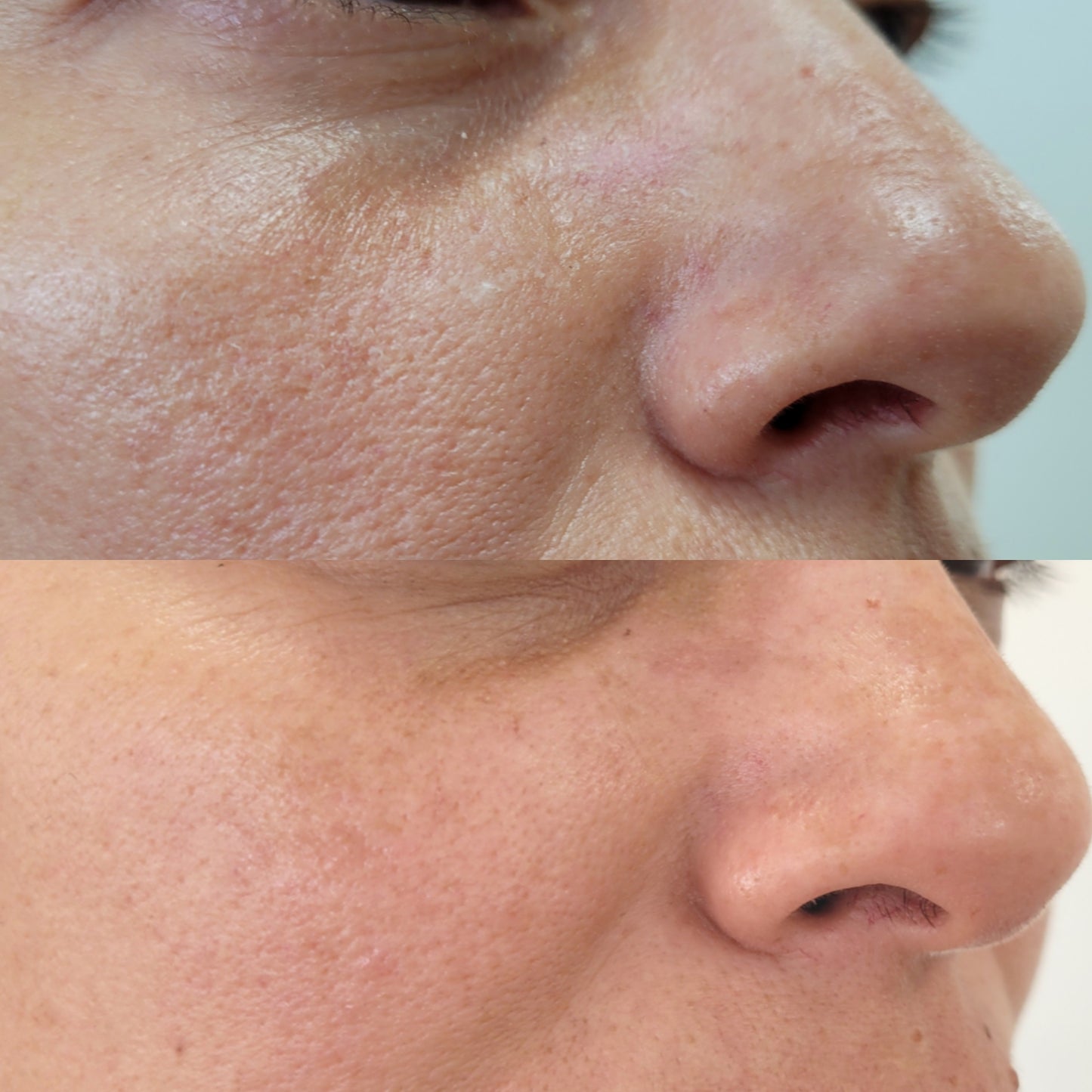 Pore Minimizer Serum