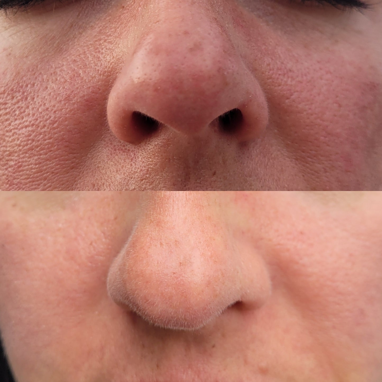 best pore minimizer