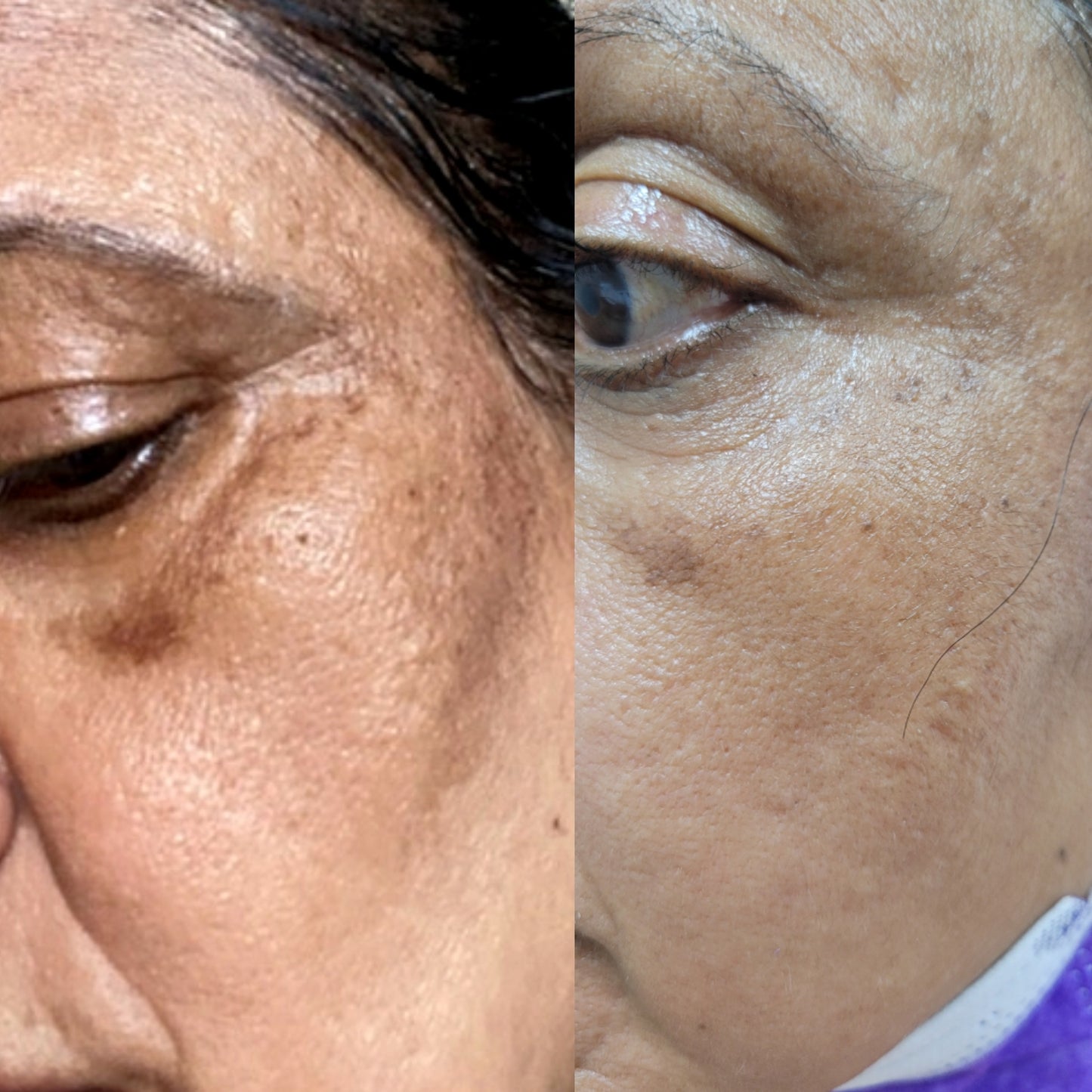 Kojic Brightening Cream