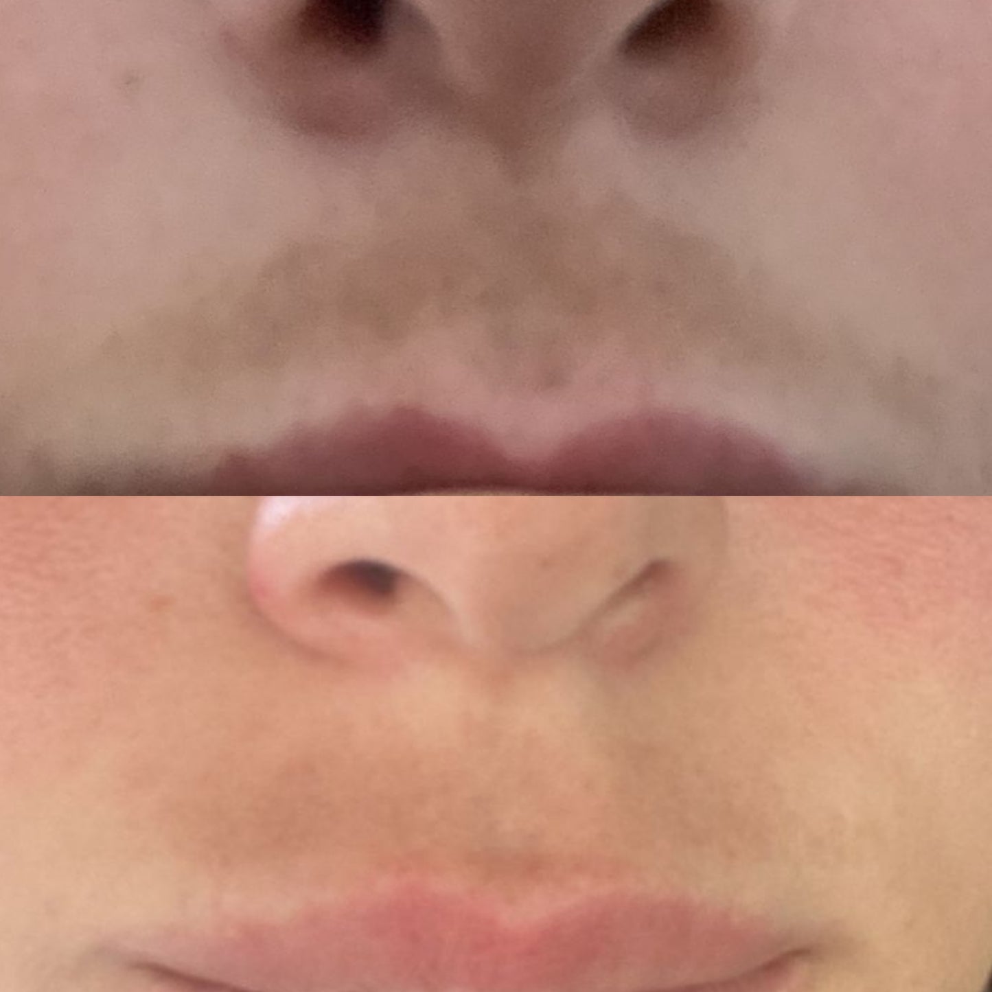 kojic acid serum