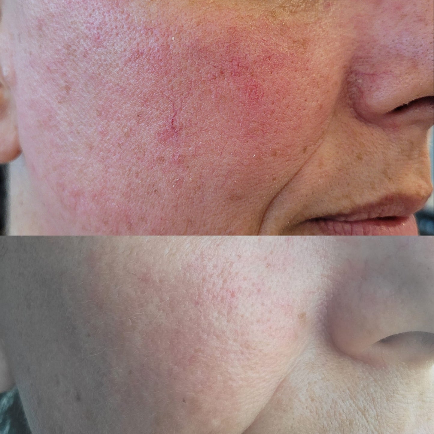 Postpartum difficulties are often accompanied by hormonal imbalances, skin challenges, and stretch marks. Danapaz is a clean botanical based skincare line designed to address sensitive skin