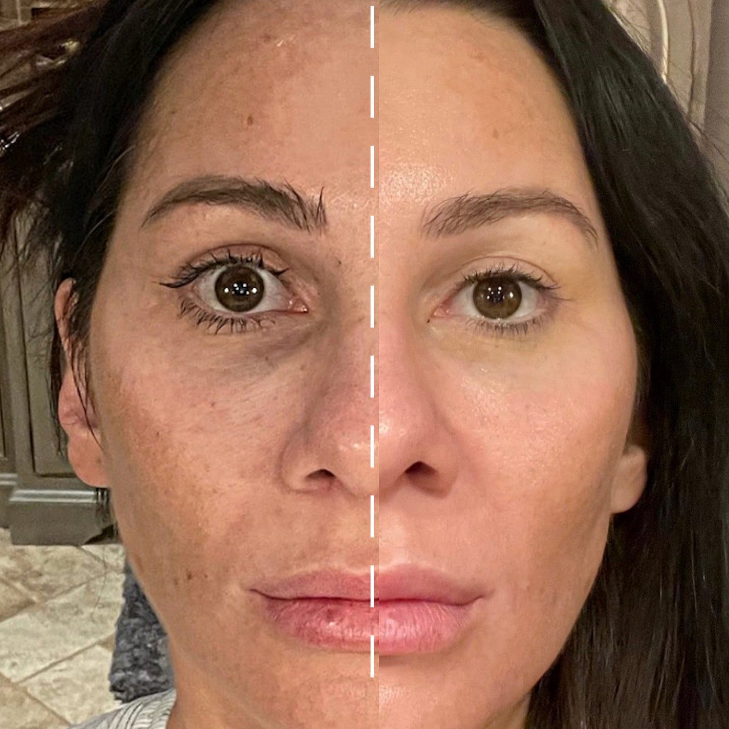skin lightening cream