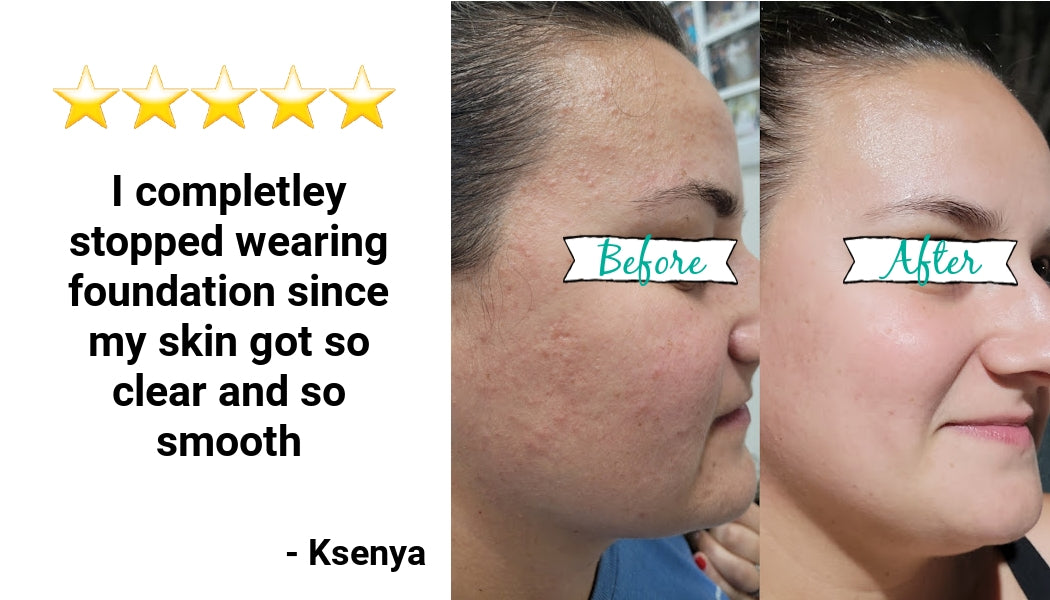 skin transformation. before and after. reviews